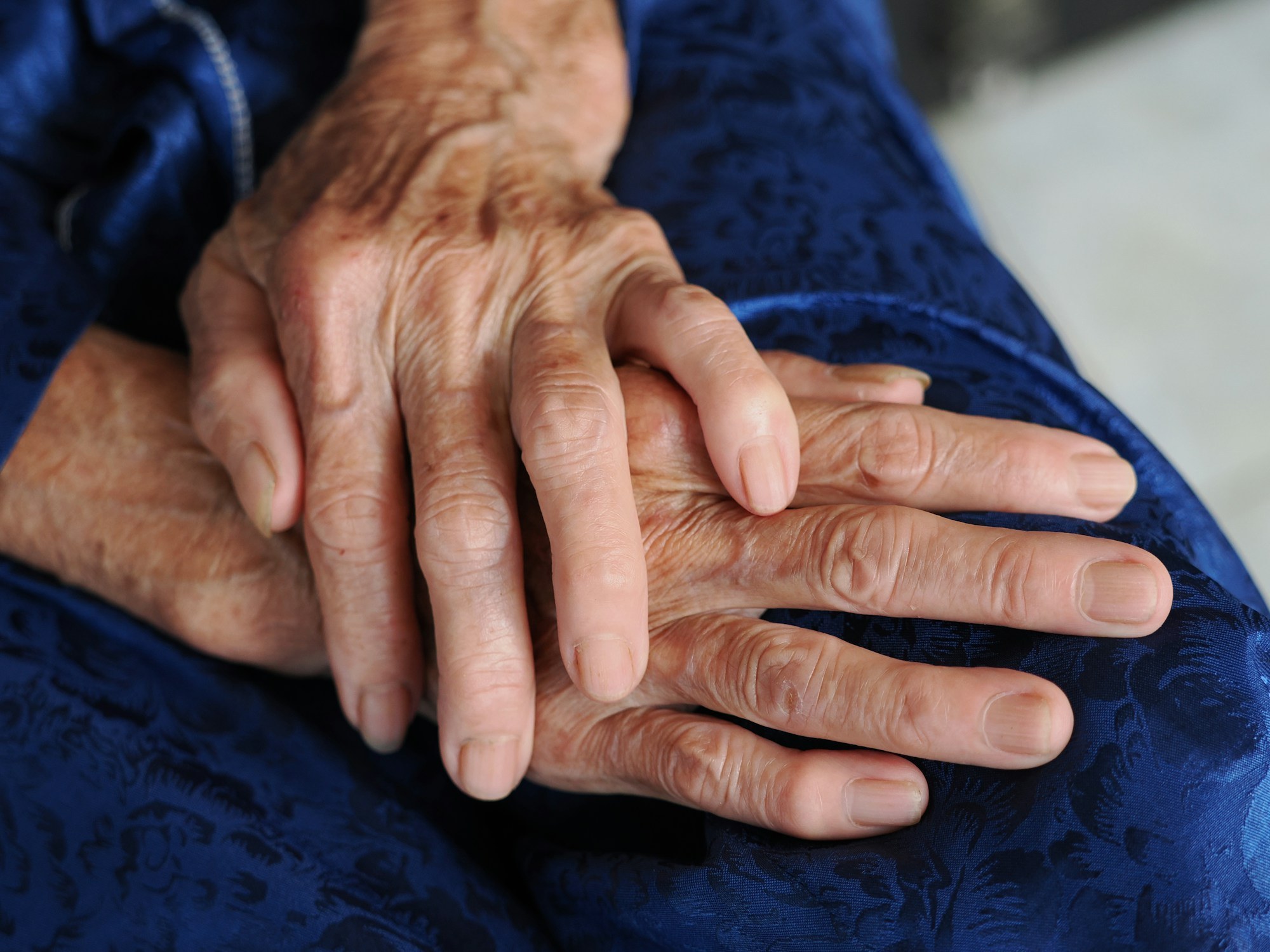 A close-up black and white photo of two elderly hands clasped together, one wearing a ring.
